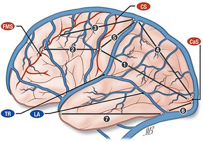 The Superficial Anastomosing Veins of the Human Brain Cortex: A Microneurosurgical Anatomical Study